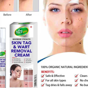 VEETGOLD SKINTAG & WART REMOVAL CREAM