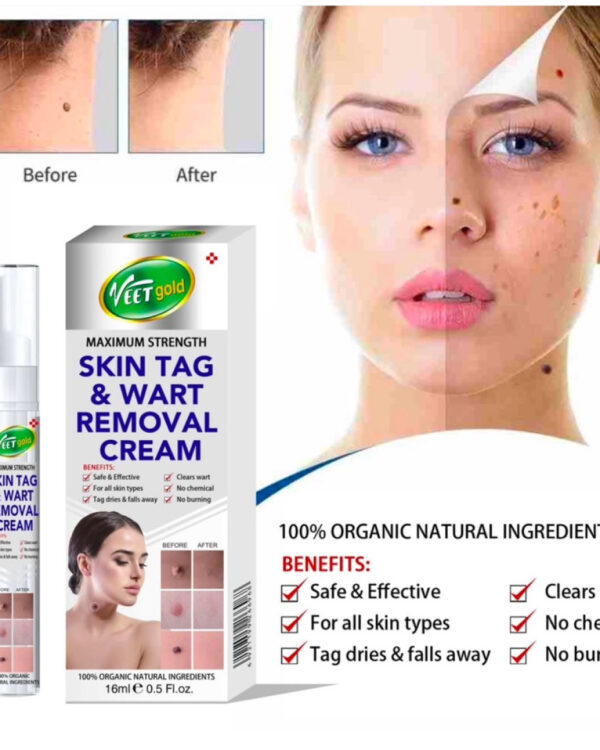 VEETGOLD SKINTAG & WART REMOVAL CREAM